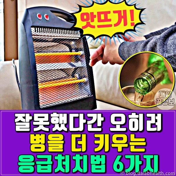 화상 응급처치법,손가락 베였을때 병원