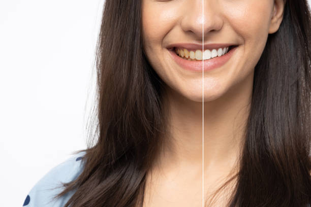 피부 미백 이미지