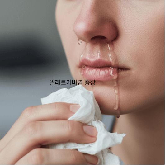 알레르기 비염 증상과 효과적인 예방법