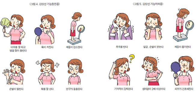 갑상선암