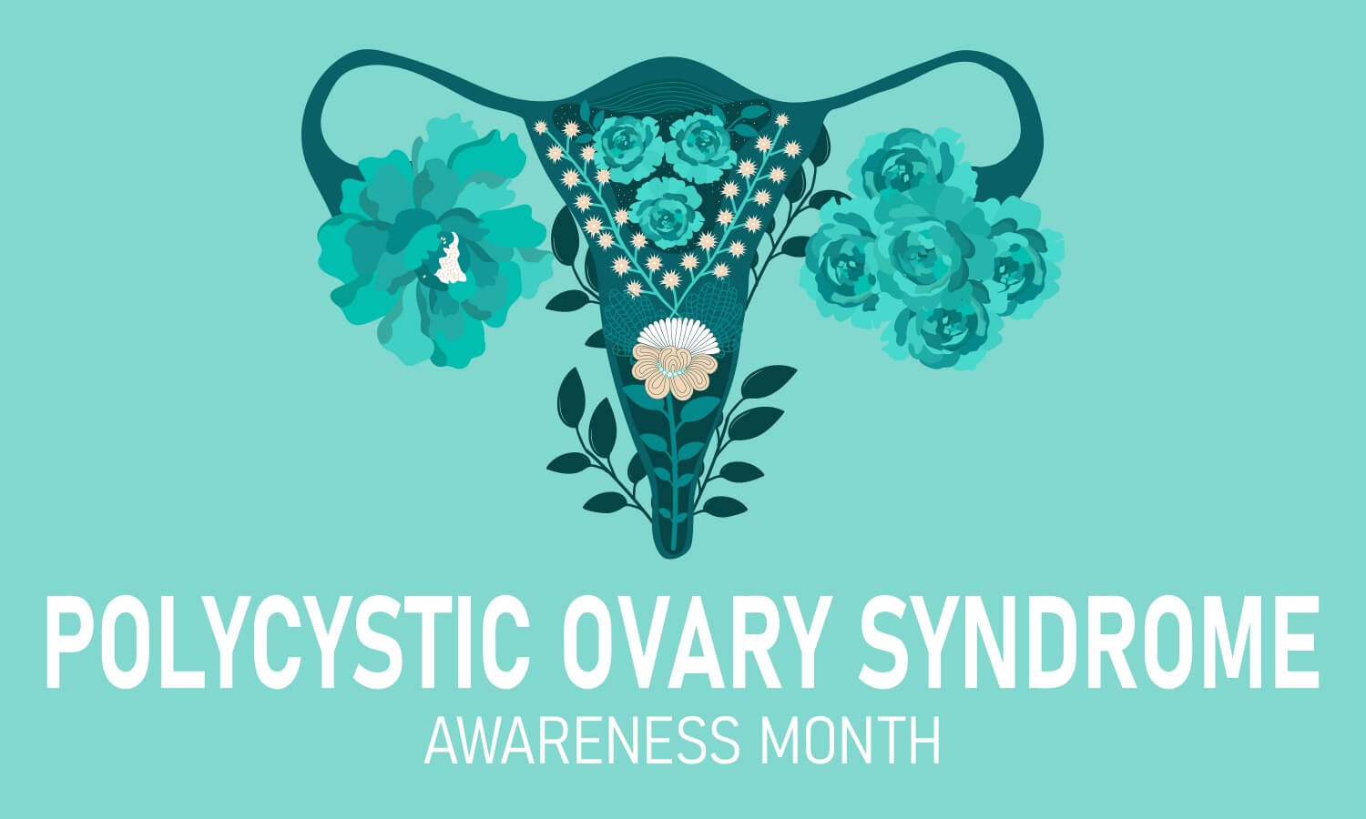 다낭성난소증후군