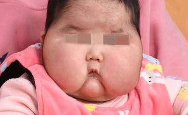중국 아기크림