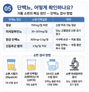 오줌에-거품-이유-증상-냄새-원인
