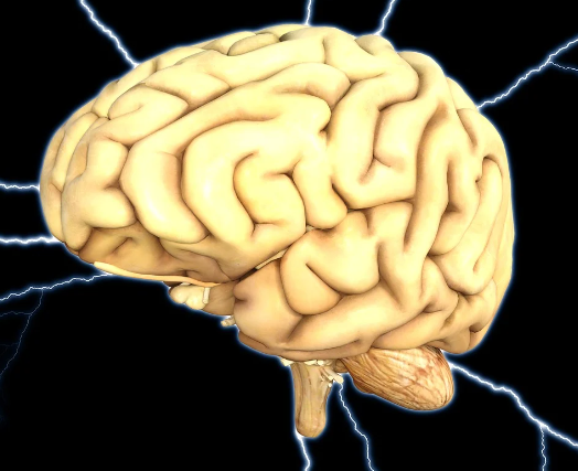 뇌경색 치료방법, 뇌경색 후유증 필수확인