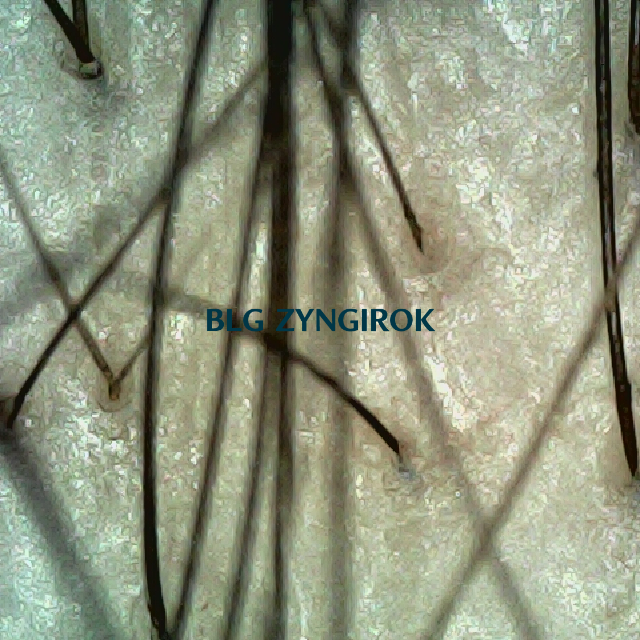 피나모아 복용 26주차 정수리와 이마 사이 부분 두피 모습이다.