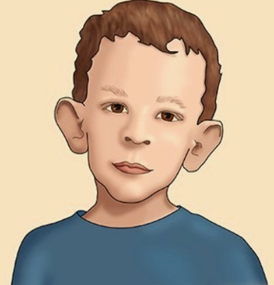 프래자일 X 증후군