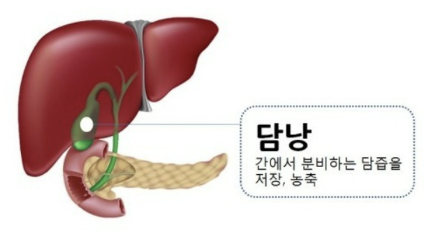 담낭염의 증상, 제거 수술, 치료 원인 좋은 음식 알아보기
