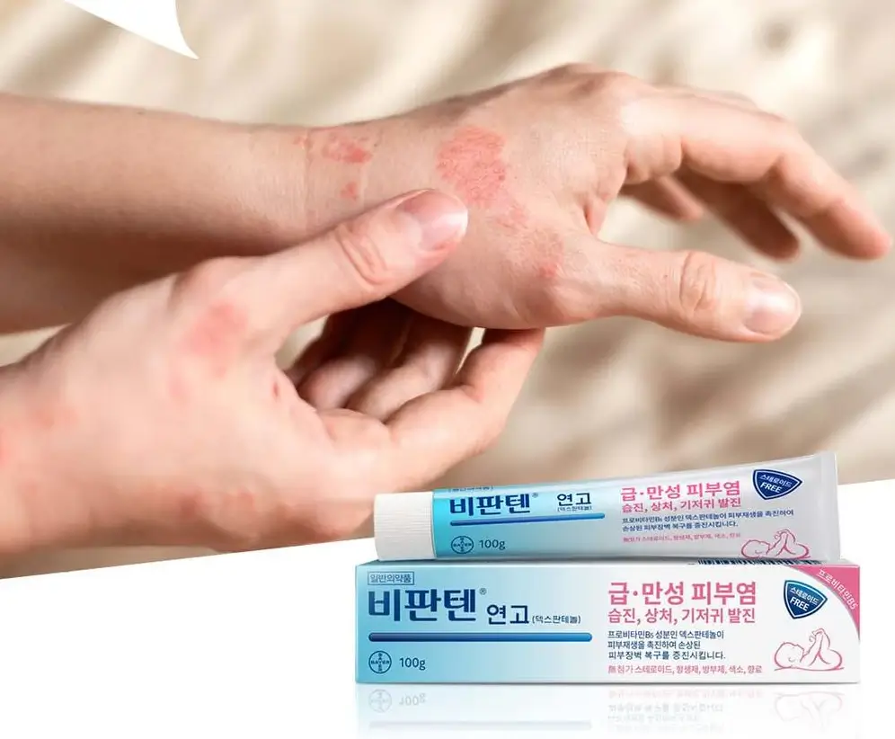 비판텐 연고 얼굴에 발라도 되나요?