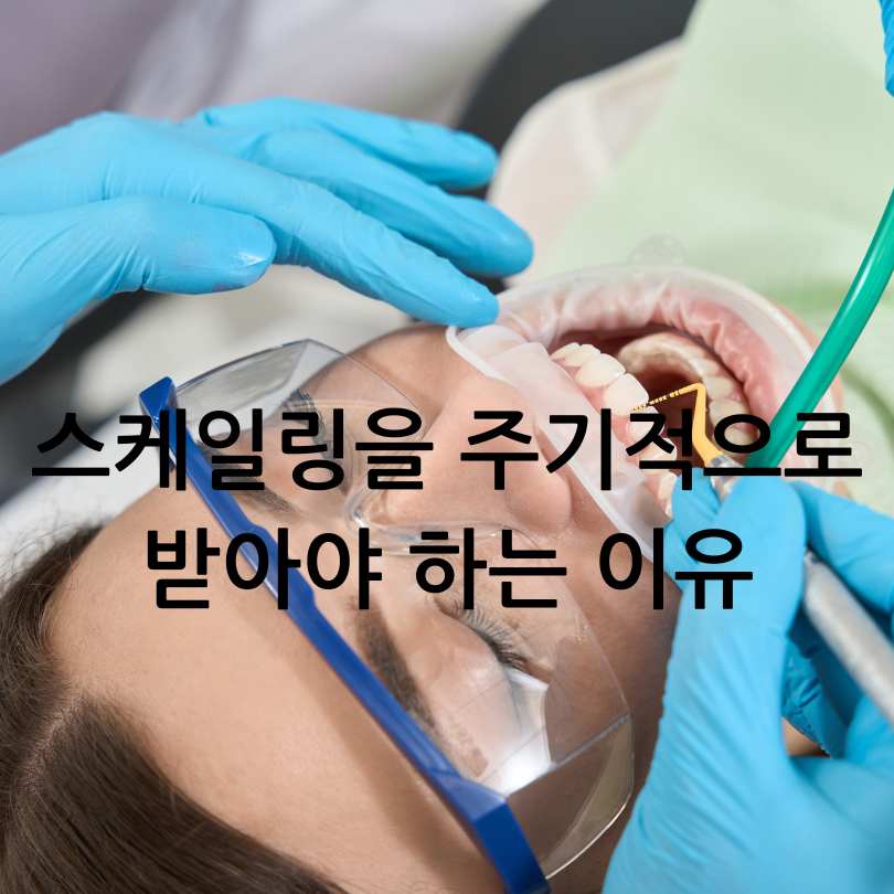 치아 스케일링의 효과와 중요성