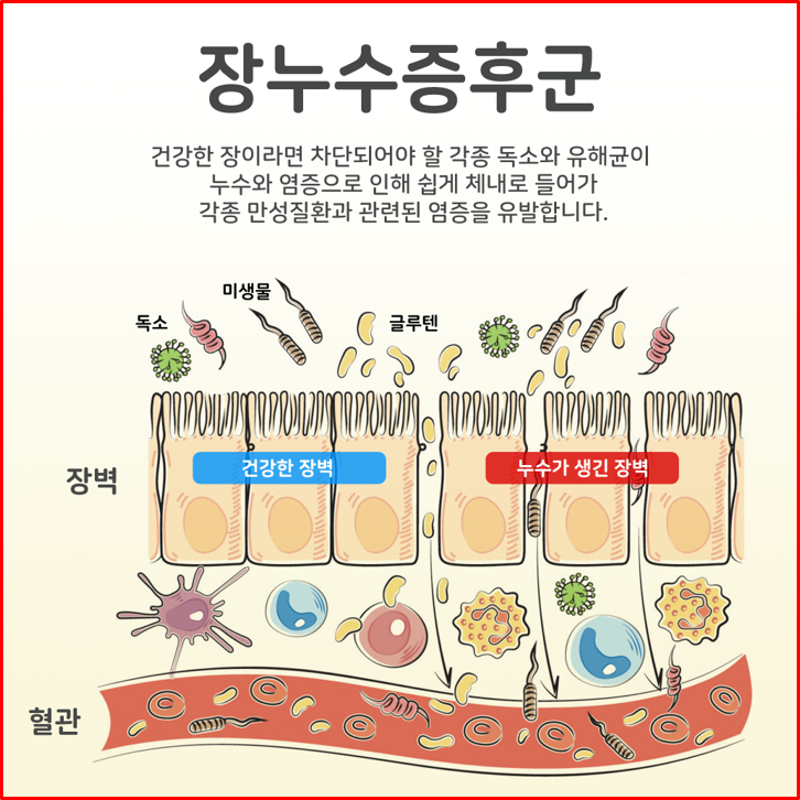 당뇨