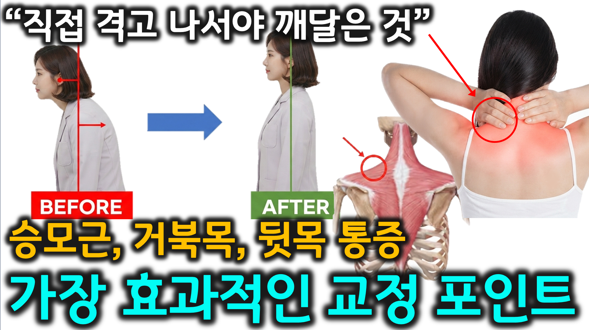 거북목과 승모근 통증 (승모근, 하부 승모근, 매달리기)