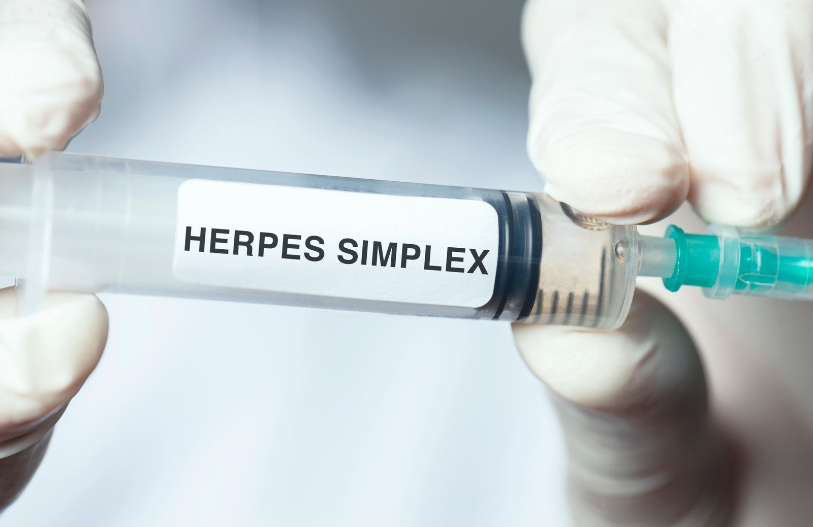 HSV-2 (단순포진 바이러스 2형) – 특징과 증상, 치료