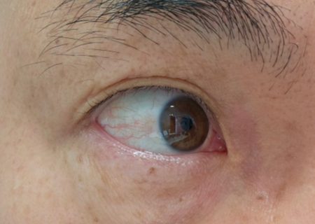 근접-촬영한-눈