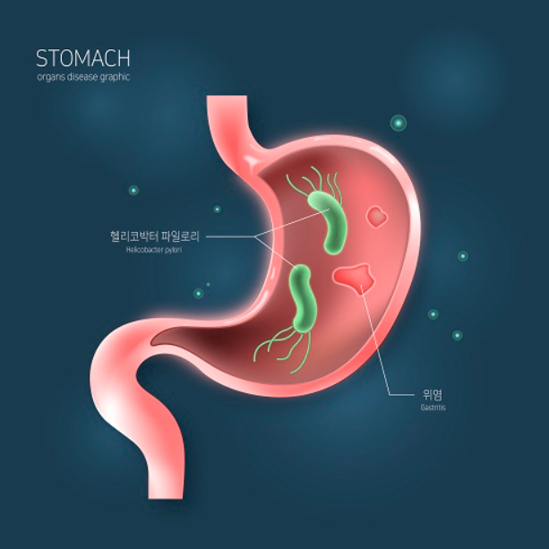 헬리코박터균-보균자-피해야할-것들-(커피?-소시지?-튀김?)