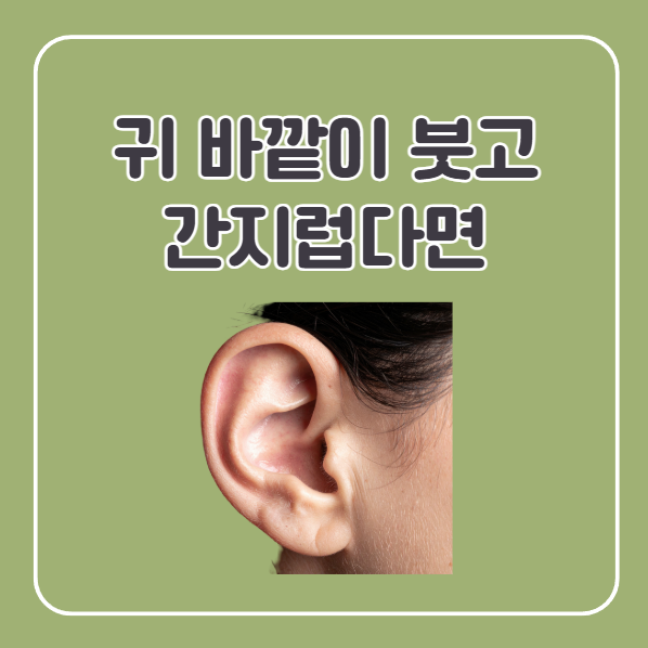 귀 밖 붓고 간지러운 증상 열감 동반, 외이도염
