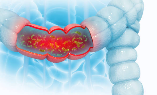 장염 증상, 원인, 빨리낫는법 총정리 (2024ver)