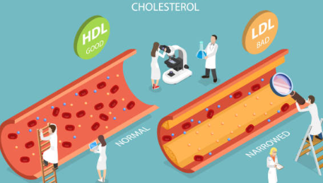 중성지방 낮추는 방법&amp;#44; 중성지방 정상수치