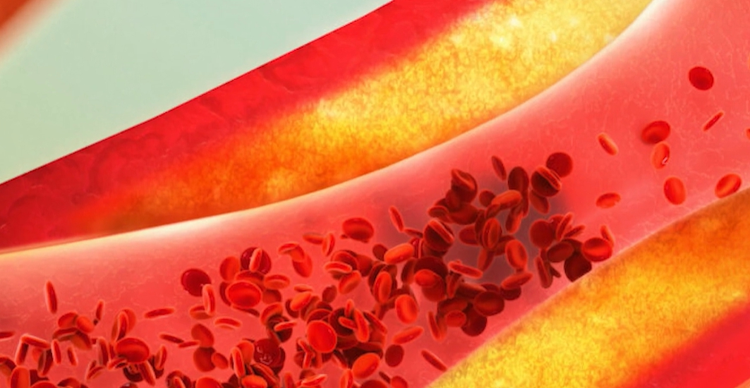 노니 효능 부작용