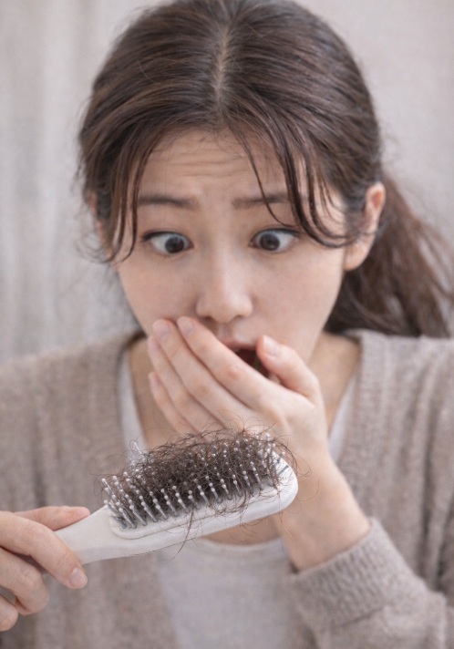 탈모 초기증상 ! 완벽정리!