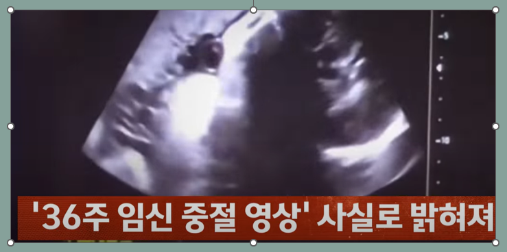 36주 임신중절 낙태 사건 파장 법적 쟁점