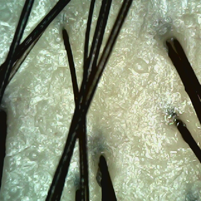 탈모 극복 프로젝트 - 정수리 두피 모습이다.