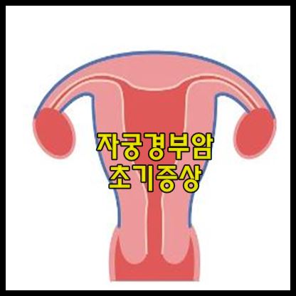 자궁경부암 초기증상