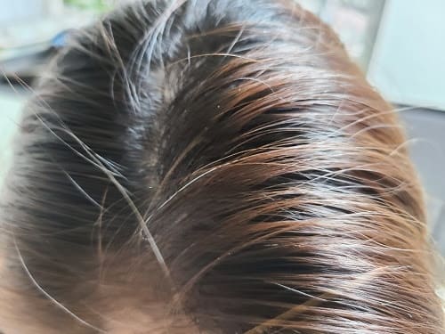 새치(White and gray hair), 뽑지 말고 잘라라 Causes of white hair