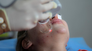 여드름 연고 일반의약품 애크논크림 애크린겔