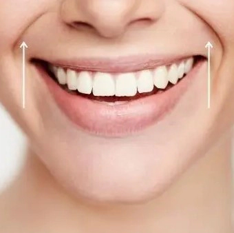 팔자주름 없애는 방법