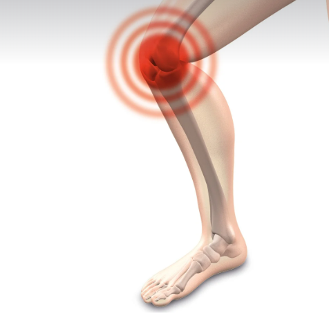 무릎연골주사 부작용, 종류, 효과 총정리