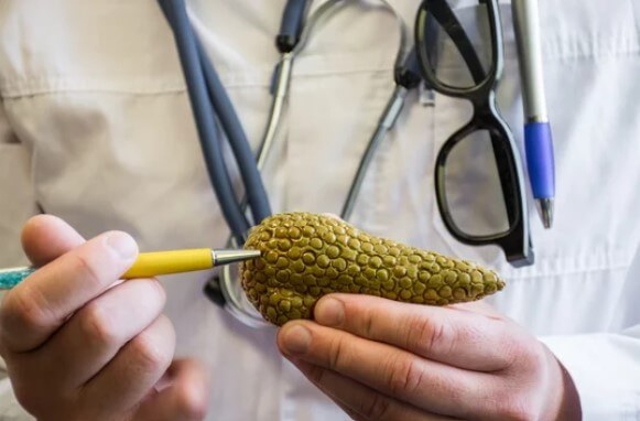 췌장의 역할 췌장암 검사 췌장암 검사종류 췌장암 검사방법 