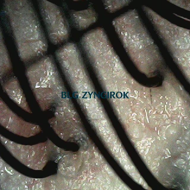 파나모아 복용 2주차 뒷머리 두피사진 모습이다.