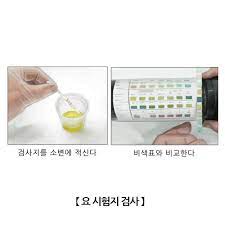 요당검사