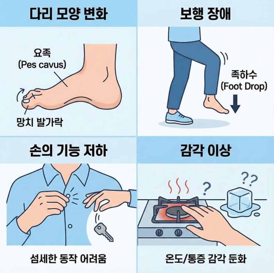 삼성가 이부진 사장 걸음걸이와 샤르코 마리 투스 유전병 팩트체크
