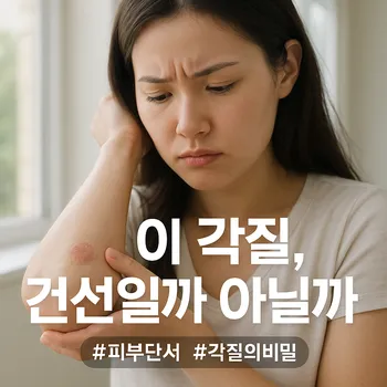 * 이미지 프롬프트: 창가에서 쏟아지는 밝은 자연광 아래, 20대 여성이 자신의 팔꿈치를 걱정스러운 표정으로 유심히 들여다보는 모습. 팔꿈치에는 경계가 뚜렷한 작은 붉은 반점이 살짝 보인다. 전체적으로 깨끗하고 희망적인 분위기를 연출하며, 인물의 표정에서 고민이 드러나는 극사실주의 사진 스타일.
* 썸네일 텍스트(제목): 이 각질, 건선일까 아닐까
* 해시태그: #피부단서 #각질의비밀