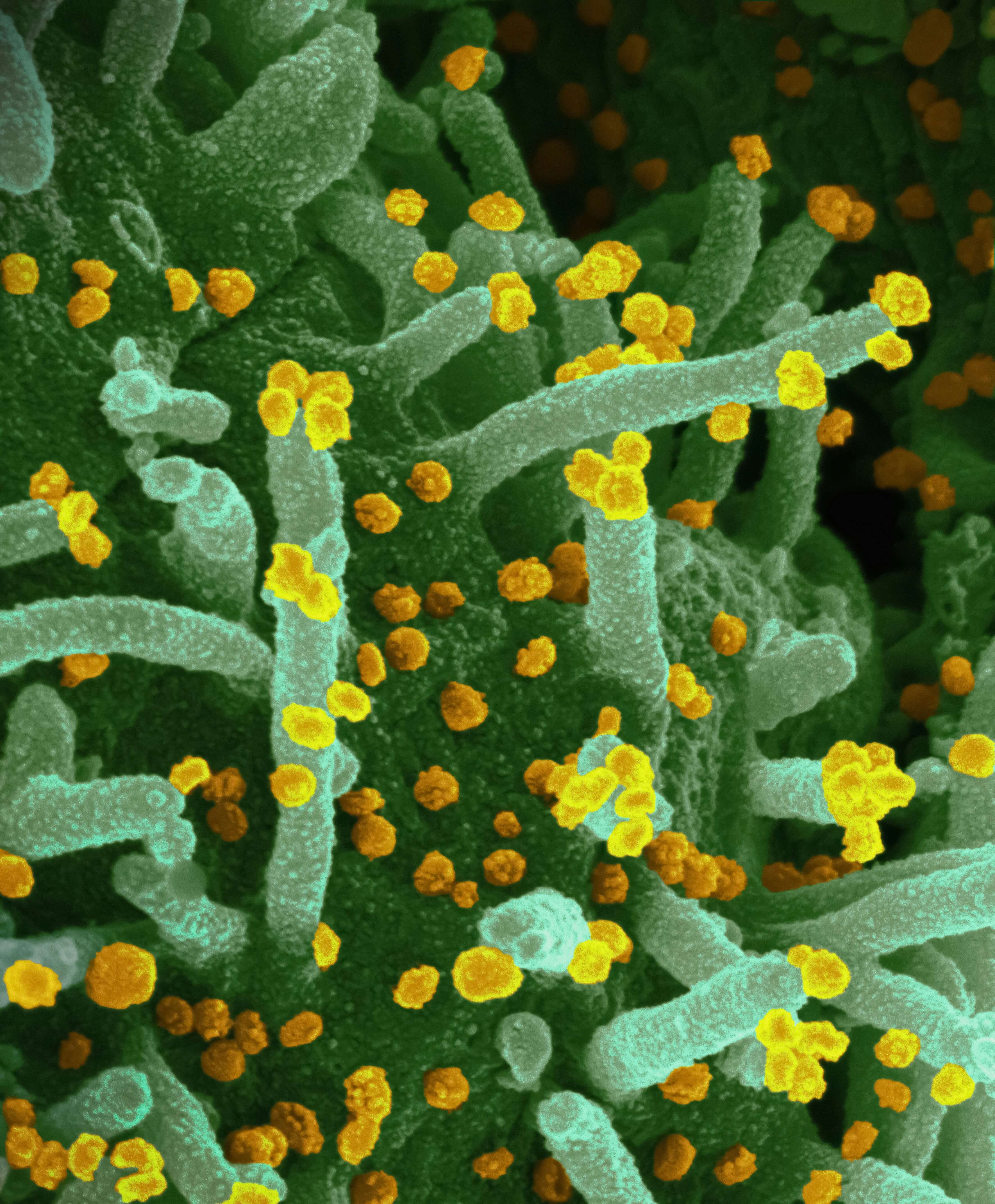 코로나19 재유행 우려