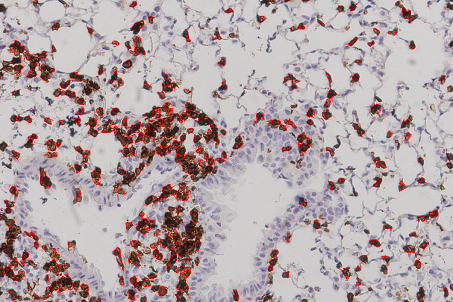 다양한 모습으로 나타나는 코로나19에 대응할 수 있는 다목적 백신 만들기