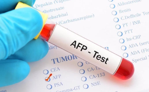afp-test