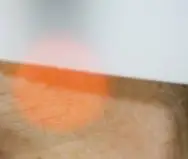 녹내장 초기 증상 &mdash; 시야를 서서히 빼앗는 침묵의 질환