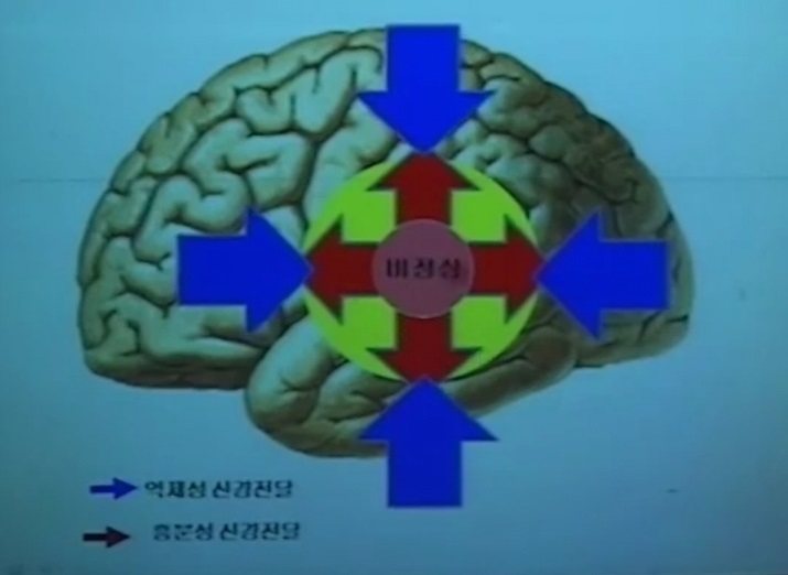 EBS명의-뇌전증-이상건-교수