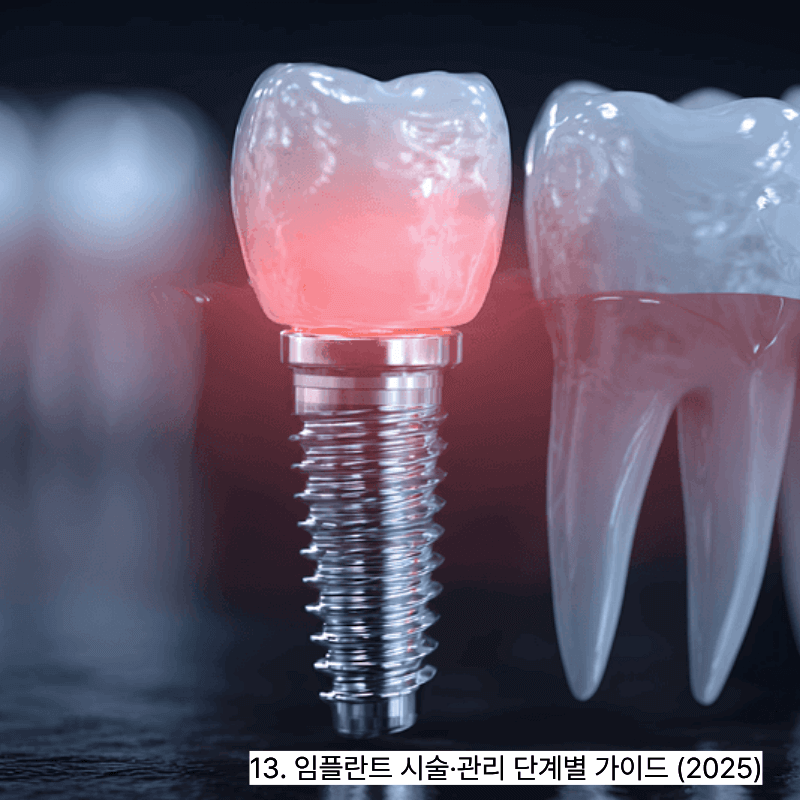 13. 임플란트 시술·관리 단계별 가이드 (2025)