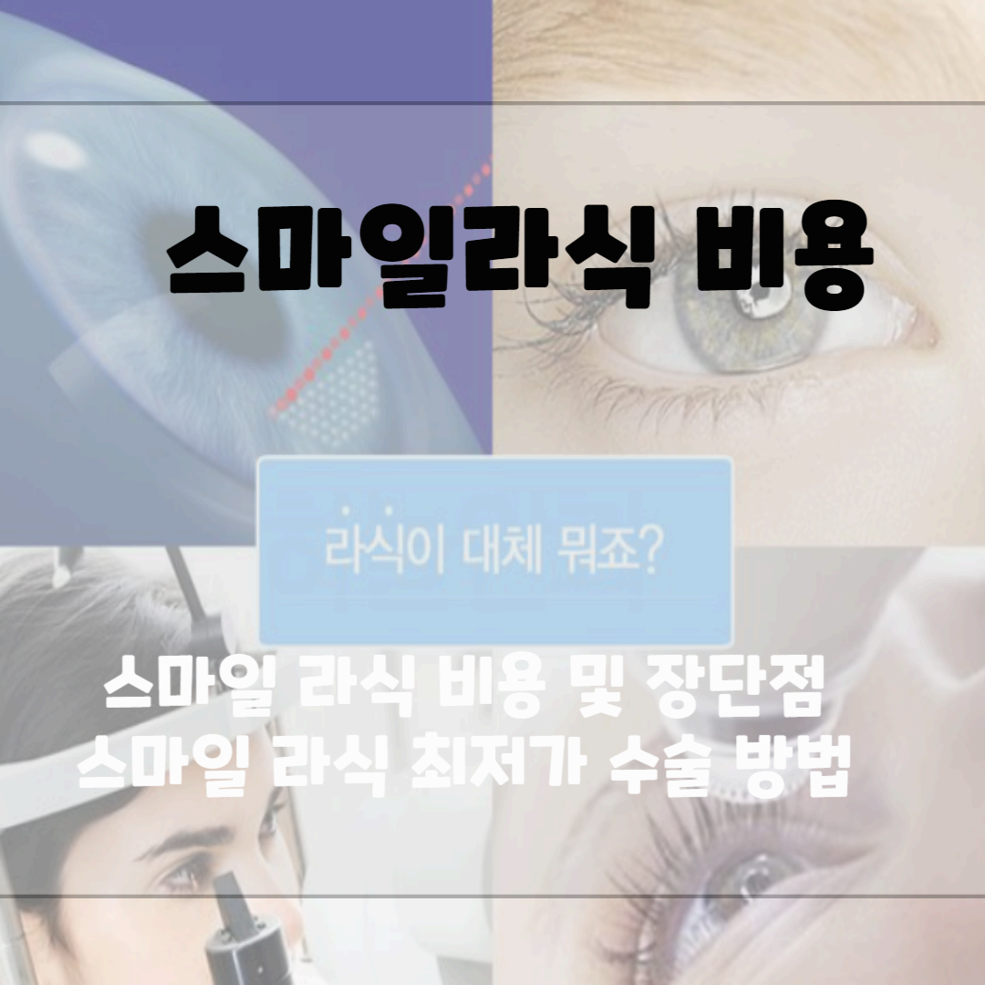스마일 라식 비용, 전국 최저가 확인하는 방버 블로그 썸네일 사진