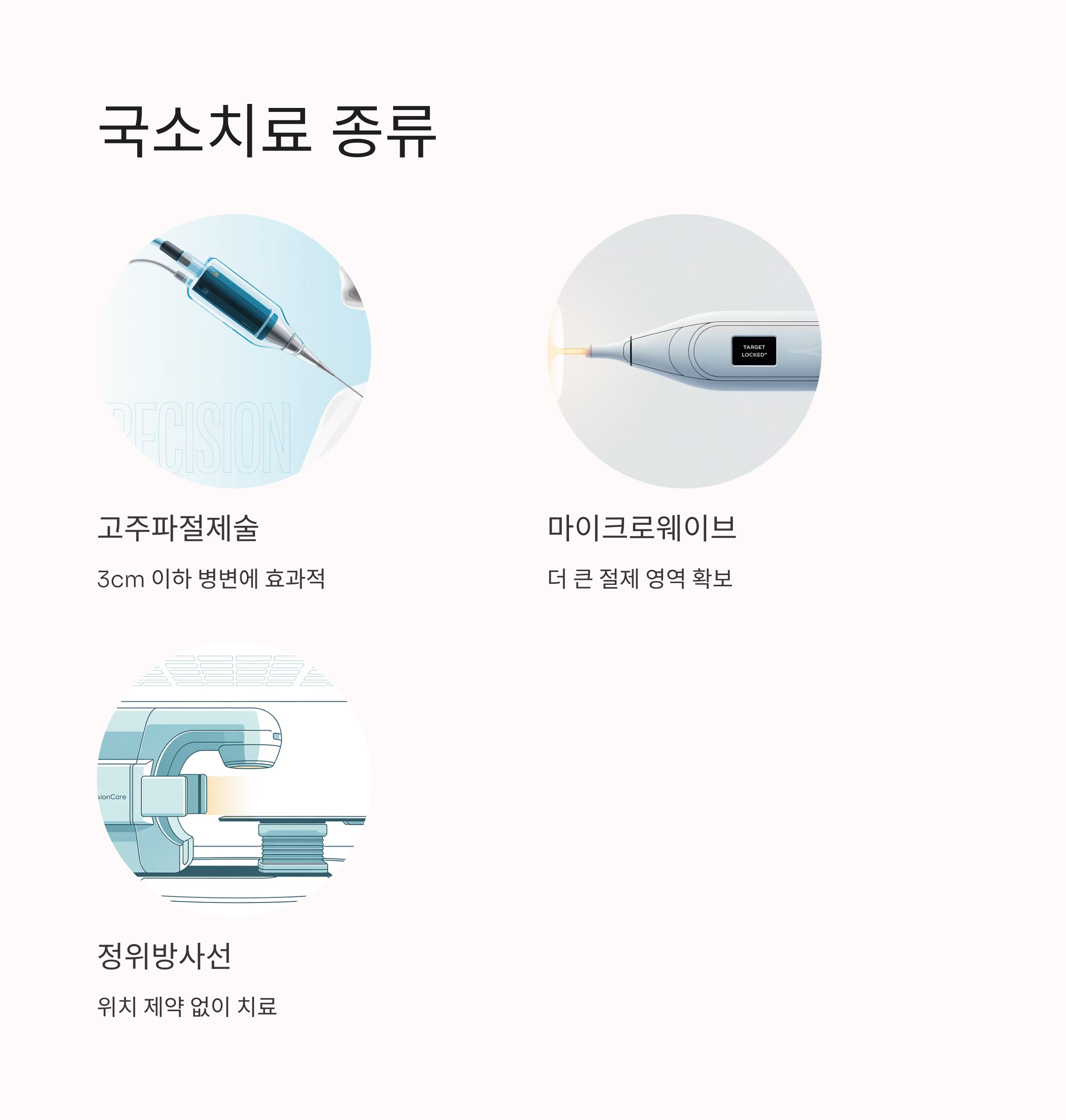 대장암 간전이 국소치료 종류