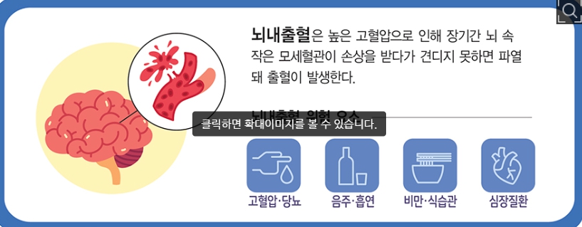 뇌혈관관련 설명이미지