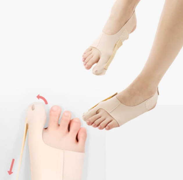 무지외반증 교정기 밴드형 교정기