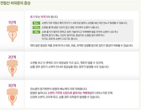 전립선비대증 치료