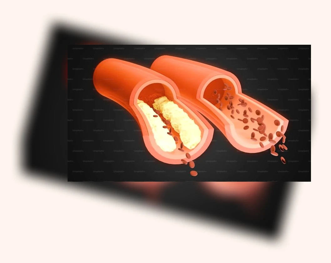 간 건강_3_subsection