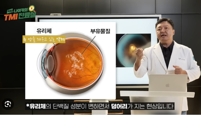 비문증 치료에도 효과있다는 '브로멜라인(Bromelain)'...그리고 파파인(Papain)