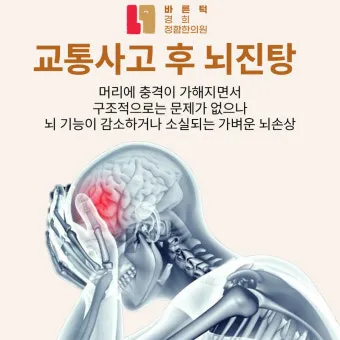 뇌진탕 초기 증상 후유증 으로_8