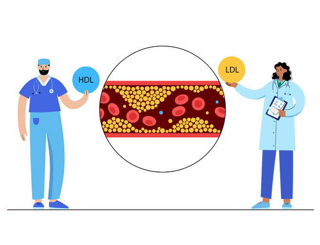 콜레스테롤 낮추는 방법